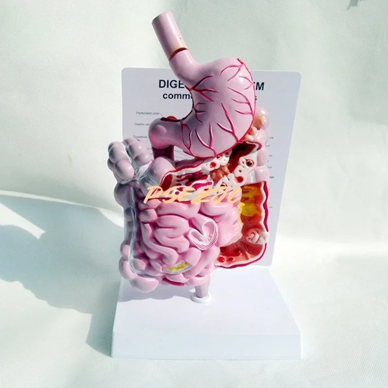 Adult Human Digestive System Large Intestine Model Duodenal Visceral Gastrointestinal Medical Anatomical Model