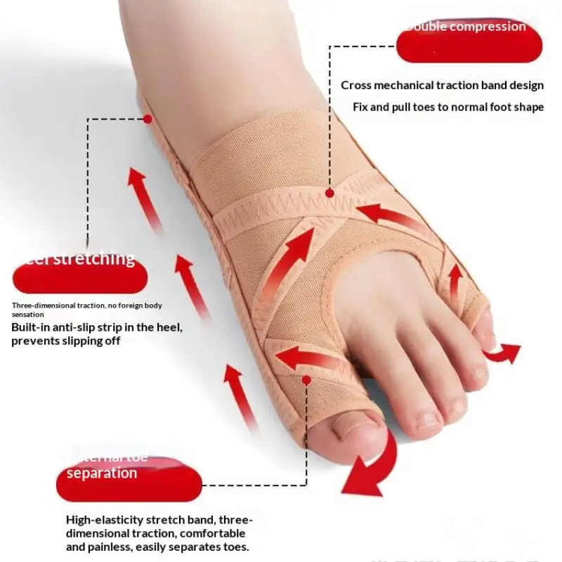 Verstellbarer Hallux-Valgus-Korrektor, Zehenspreizer, Orthopädische Einlagen, Fußknochen-Gerät zur Korrektur von Hallux Valgus, Pediküre-Fußpflege-Werkzeuge – Detail 5