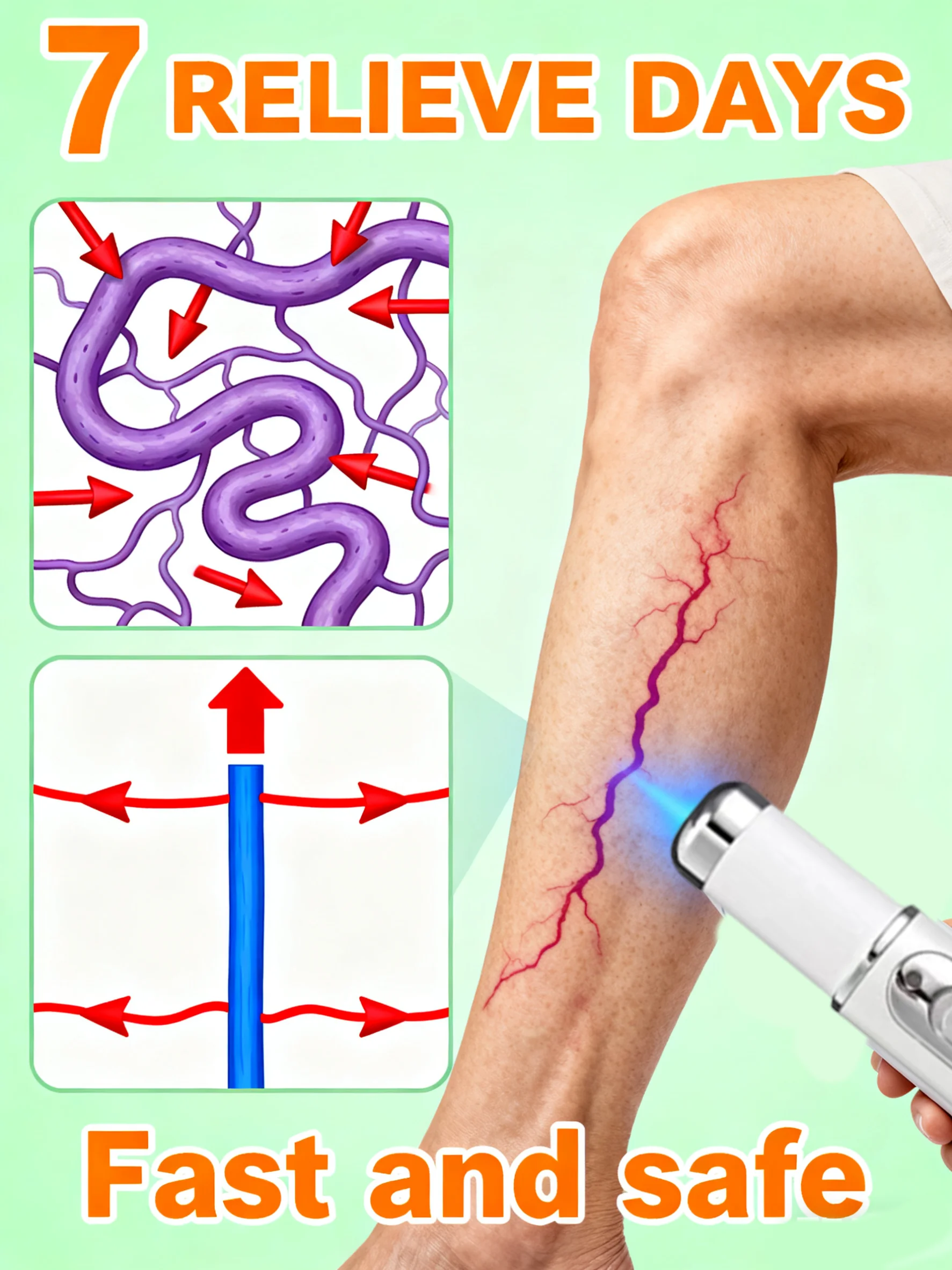 قلم ليزر أزرق مطور حديثًا، يحل الدوالي، مما يسمح لك أن تتمتع بأرجل صحية جديدة 2020 #1