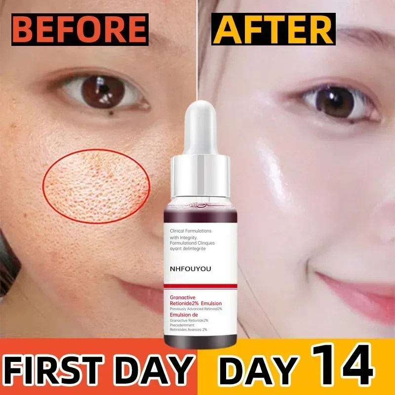 Pore Shrinking Serum Face Removing Large Pores Tightening Repairing Facial Pore Minimizing Essence Skin Care Beauty