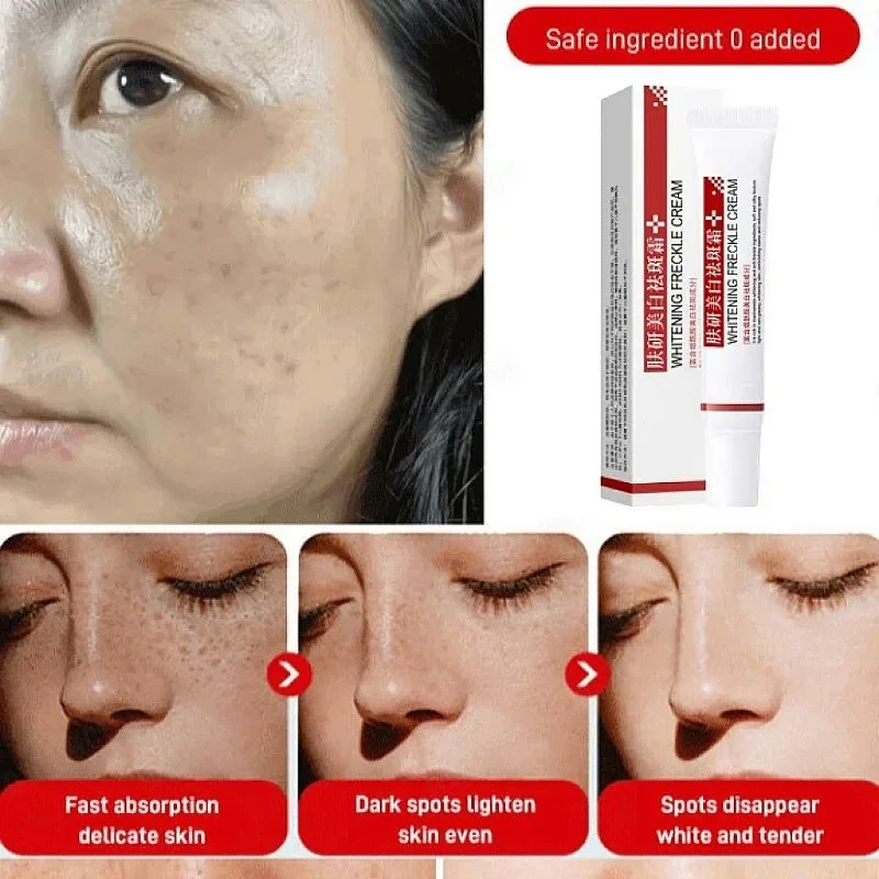 Face Quick Freckles Removal Cream Lightening Melanin Emulsion Reduce Melasma Brighten Cream for Dark Skin Women Whiten Product