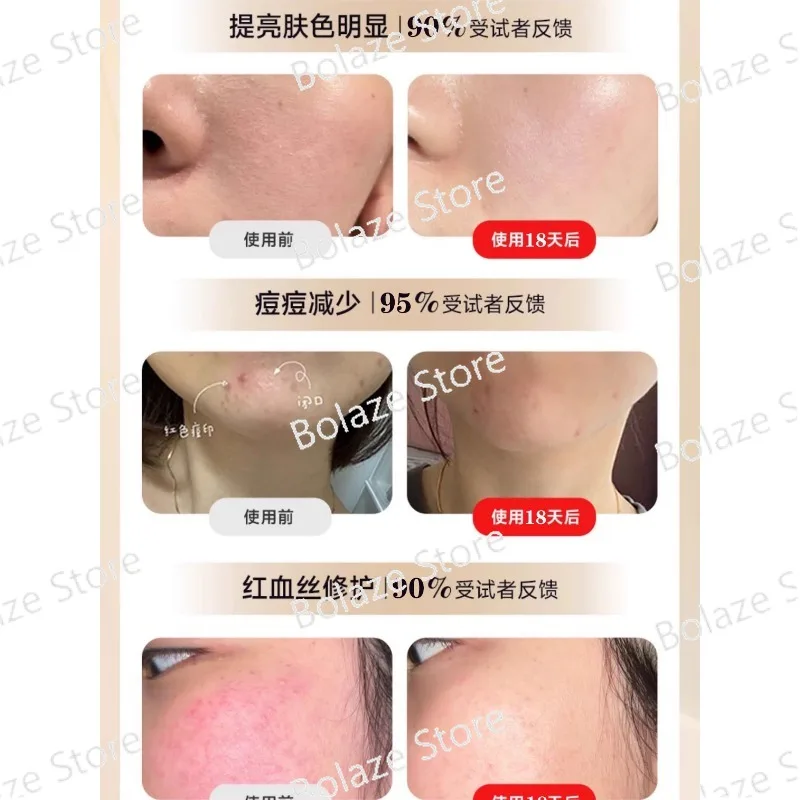 G20 PDT Phototherapy Instrument Red and Blue Light Beauty Instrument Repair and Acne Removal Spectrometer To Beauty Salons