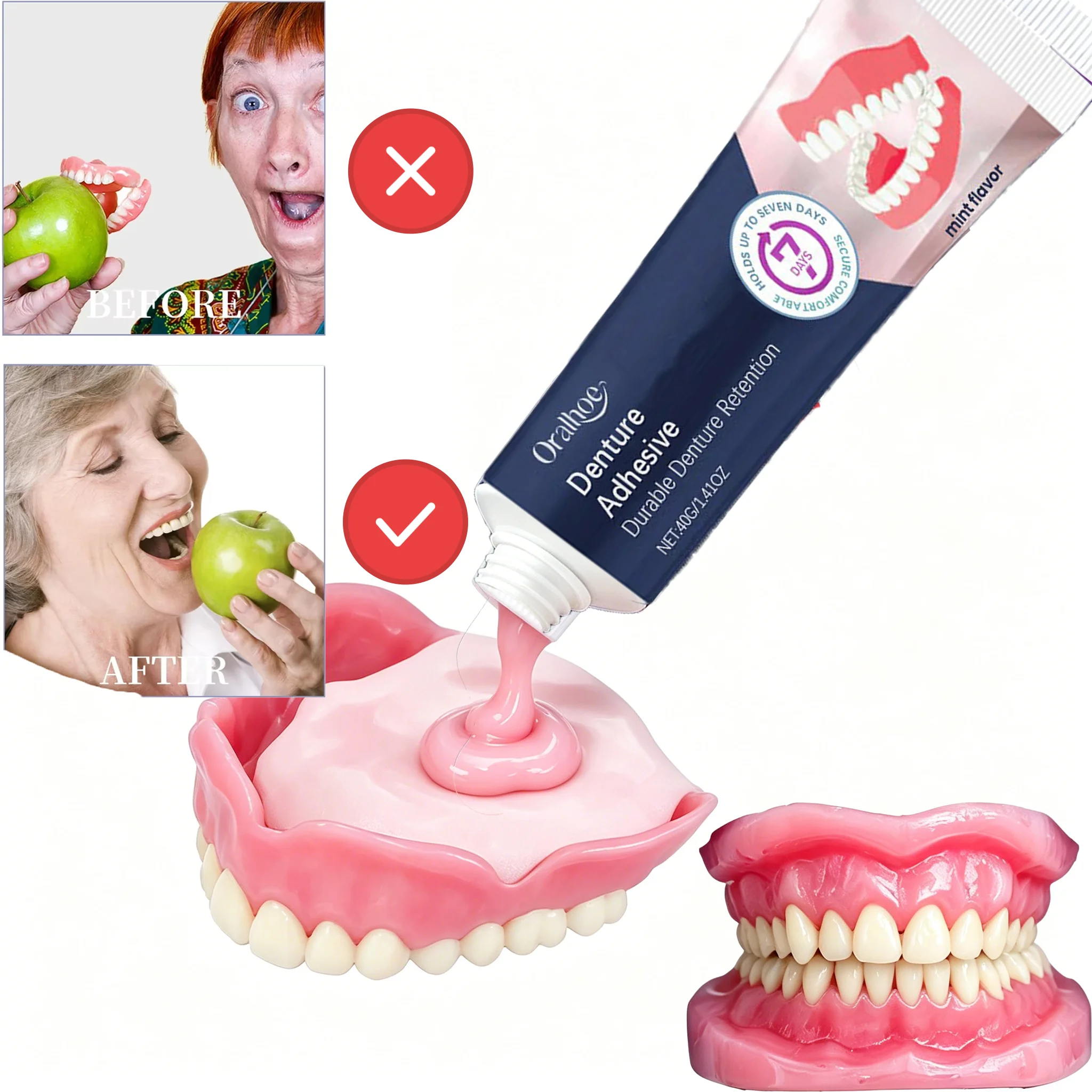 Adhesivo Termoplástico para Dentaduras Postizas – Fija Dentaduras Sueltas, Reacondiciona para un Ajuste Seguro y Cómodo, Amortigua las Encías, Resistente al Agua y Sin Zinc