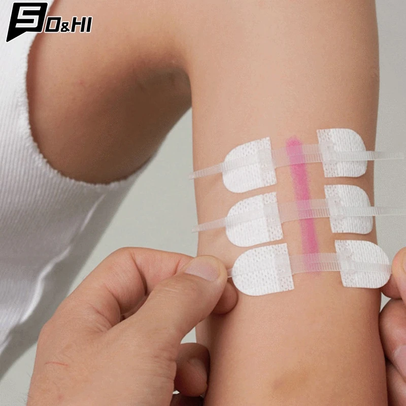 3Pcs Zipper Tie Wound Closure Patch Hemostatic Patch Wound Fast Suture Zipper Band-Aid Outdoor Portable Skin Care