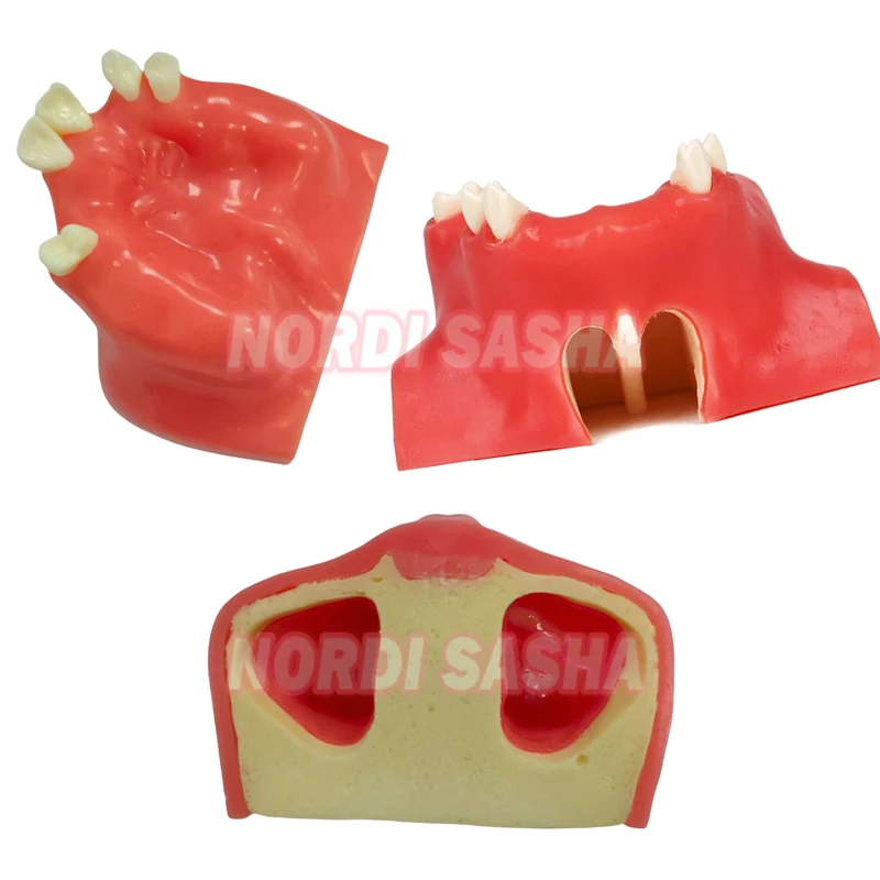 

Dental Implant Teaching Model Maxillary Mandibular Sinus Model Soft Gums Teeth Model For Dentist Practice Studying Tools