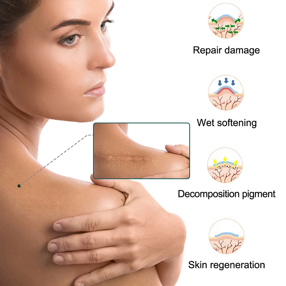 Flow Week Scar Silicone Strips Professional Scar Removal Sheets Effective Scar Removal Strips for C-Section Keloid Surgery Burn