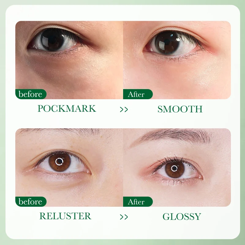 스노우 그라스 영양 공급 및 복구 아이 크림, 잔주름 제거, 눈가 붓기 완화, 눈가 주름 개선, 탄력 강화, 다크서클 완화, 보습 효과 V6J7