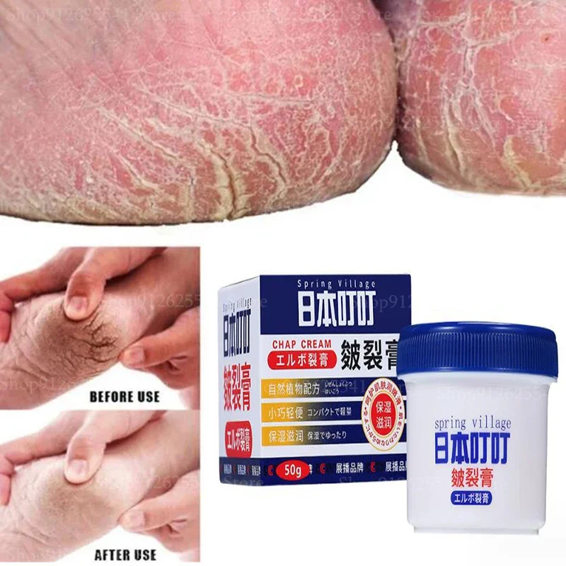 50g Anti-Drying Crack Foot Cream for Removing Dead Skin and Dry Heels Hand and Foot Protection Cream for Anti Freezing