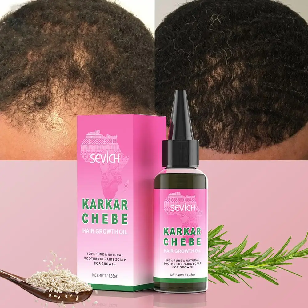 

2024 New Super Growth Oil Karkar Regrowth Thicken Oils Oil Rosemary Serum Essential Loss Hair Products Chebe Anti-Breakage W2Y4