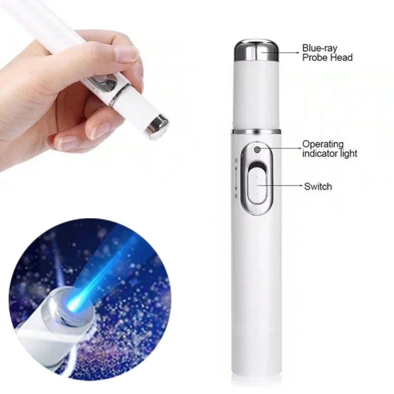 Nagel Pilz Stift Anti Pilz Blaulicht Laser Stift Onycho mykose schmerzlose Nagel Reparatur Stift Nagel pflege Reparatur Serum Nagel Reparatur Stift