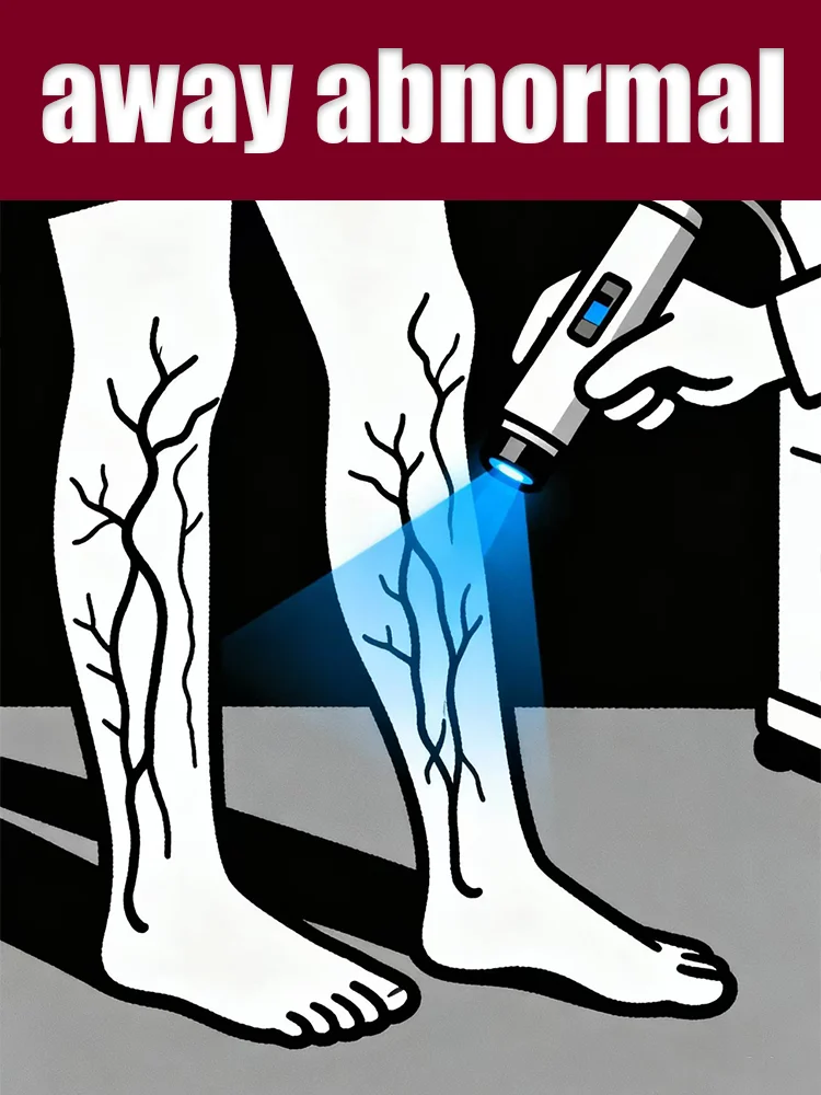 

Blue light pen for highlighting prominent veins on the legs