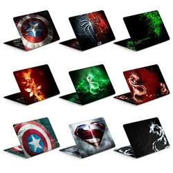 Universal Laptop Skins Sticker Vinyl Waterproof Skin 13.3