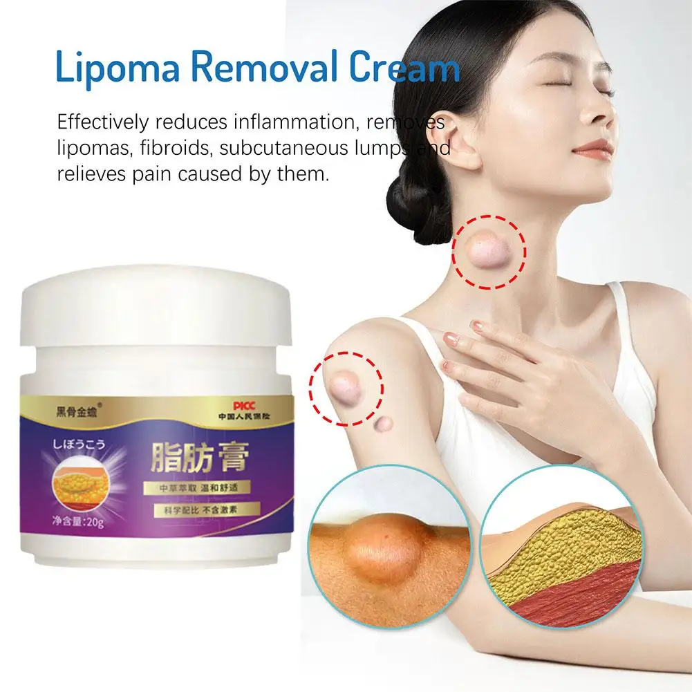 

5pcs Lipoma Removal Cream Fatty Tumor Ointment Specialized Chinese Medicine Eliminate Lumps Multiple Genuine Skincare Products