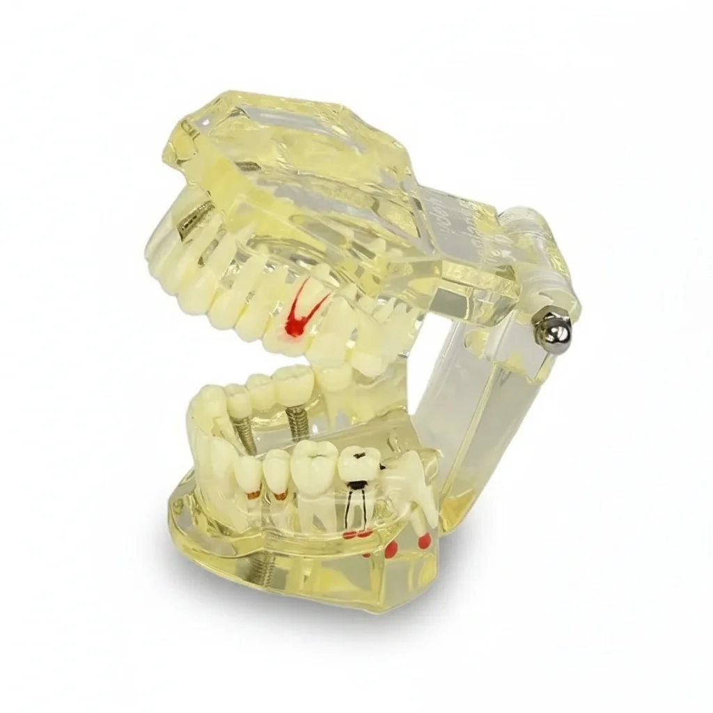 

Typodont 2001 Resin Dental Study Model, Standard Adult Restoration Model for Education, Resin Teeth, 12 x 10 x 8 cm