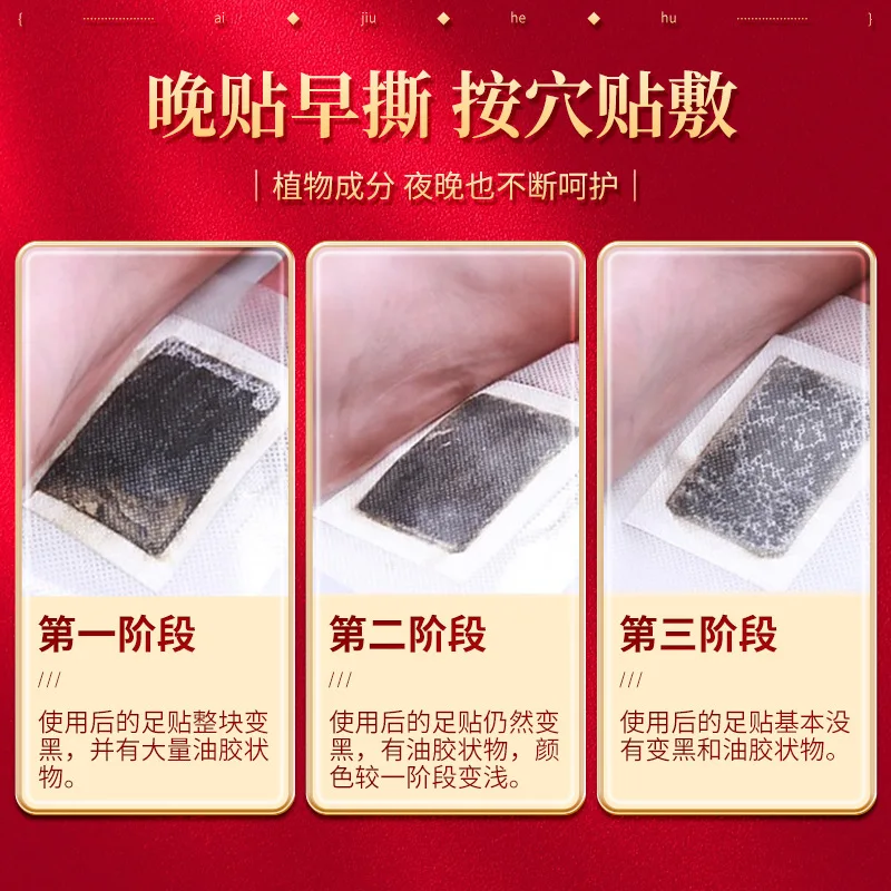 Old Beijing foot stickers 100 sticks wormwood foot stickers foot care supplies foot stickers ginger cleaning tools