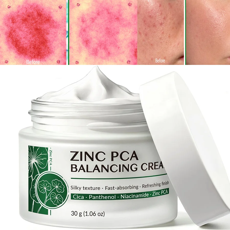 Zinc PCA Blemish Relief Cream, Face Moisturizer For Acne-Prone Skin, Lightweight, Breakouts, Barrier Repair, Hydration,Soothing