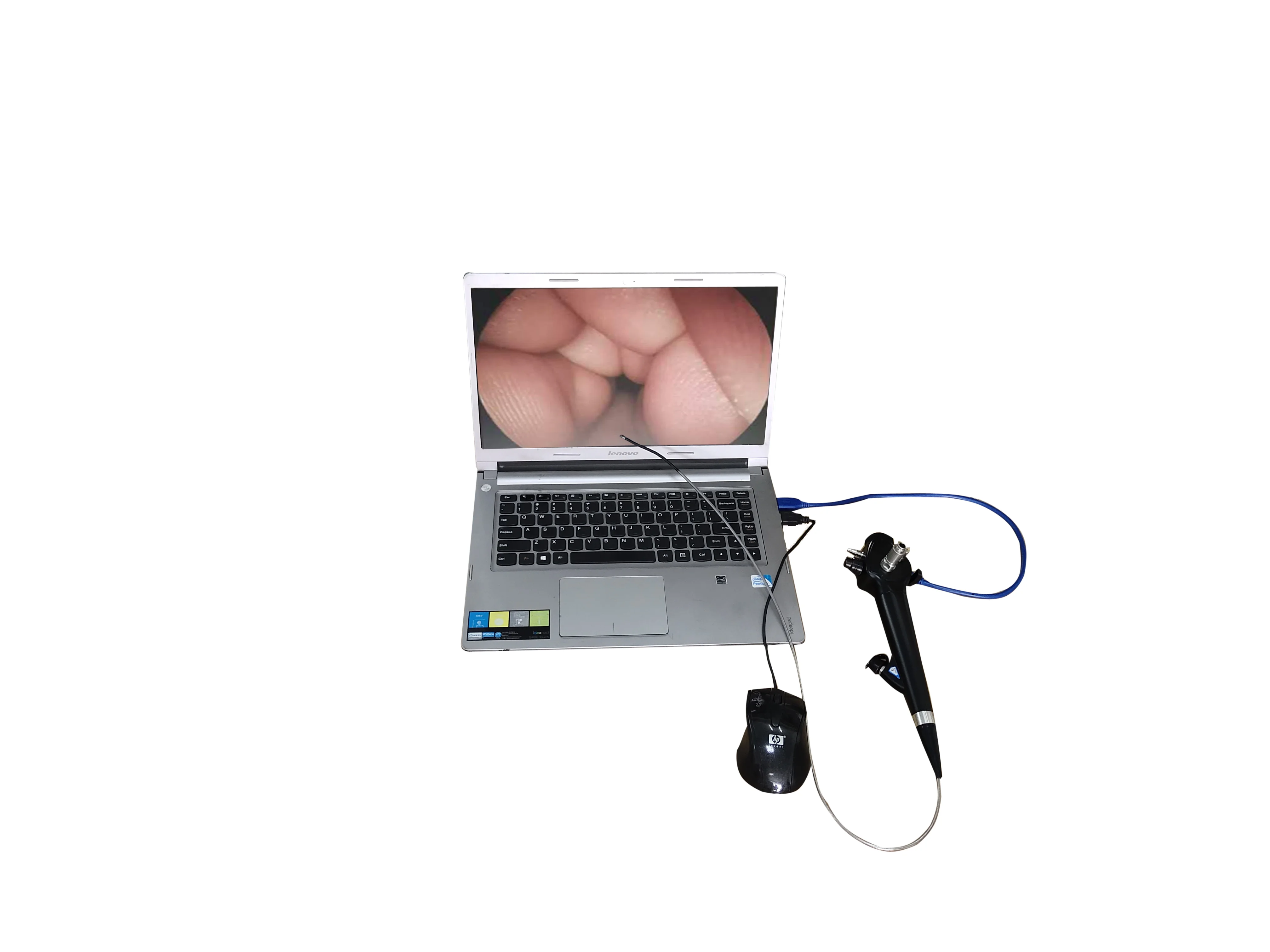 Endoscopic Surgical Equipment Portable Electronic Flexible USB Video Gastroscope Colonoscopy Price