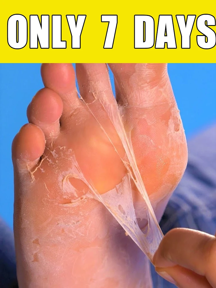 

7-Day Foot Exfoliating Spray, suitable for dry, rough, cracked feet, heels, and calluses.