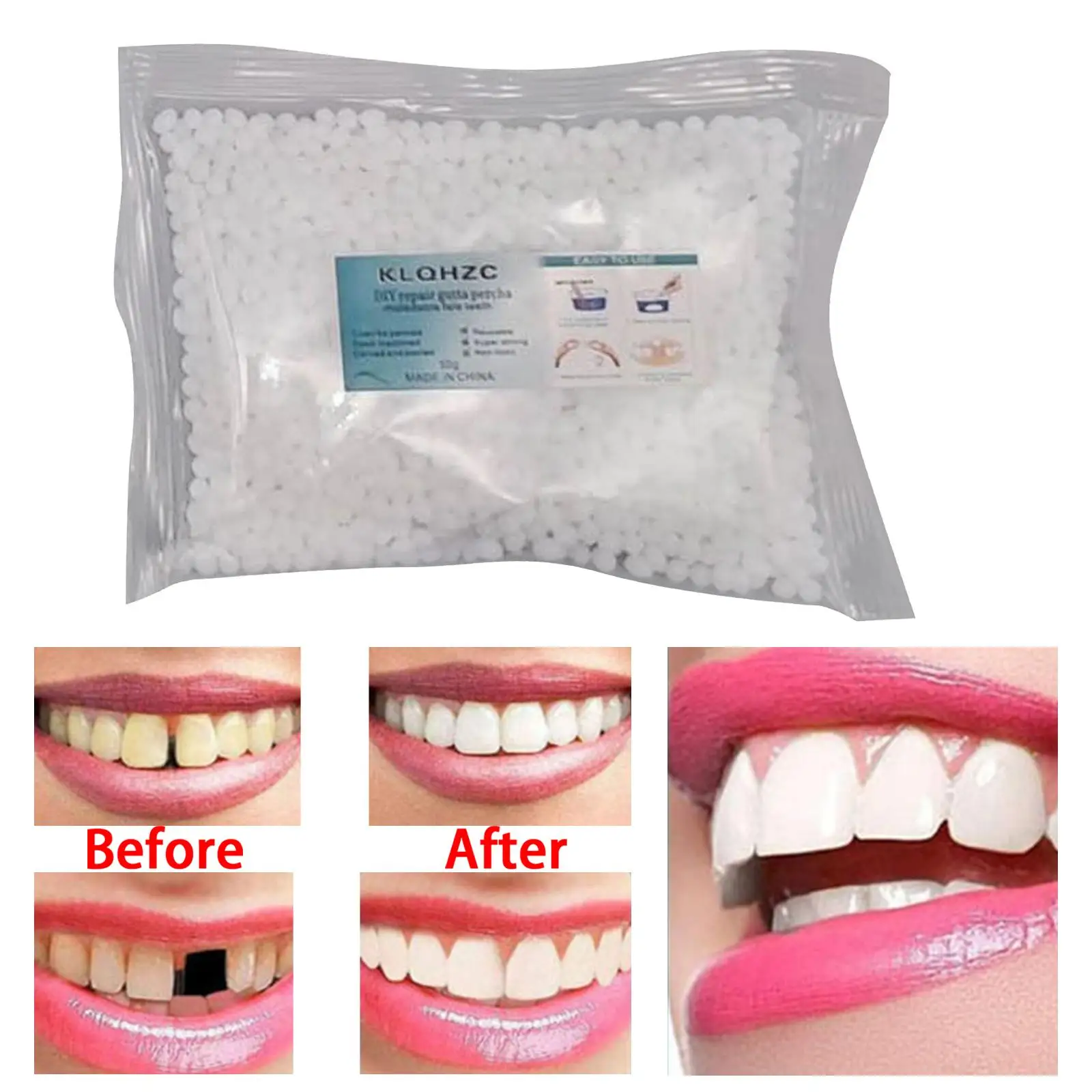 Repair Kit Repair Granules Tooth Adhesive Filling Fix The Missing Broken Tooth Thermal Fitting Beads