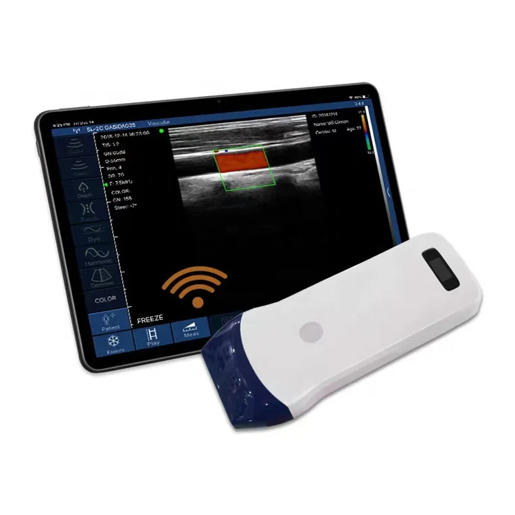 Hot Sale Double Probes Wireless Color Doppler Ultrasound Scanner Wifi Ultrasound