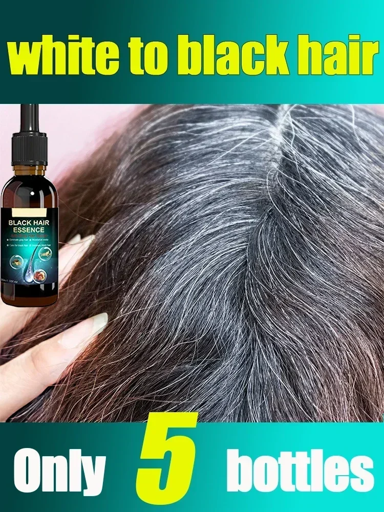 Nutrir o cuidado anti-perda do cabelo para homens e mulheres, tratamento líquido, cinza, cor branca a preta, reparo, soro do tratamento