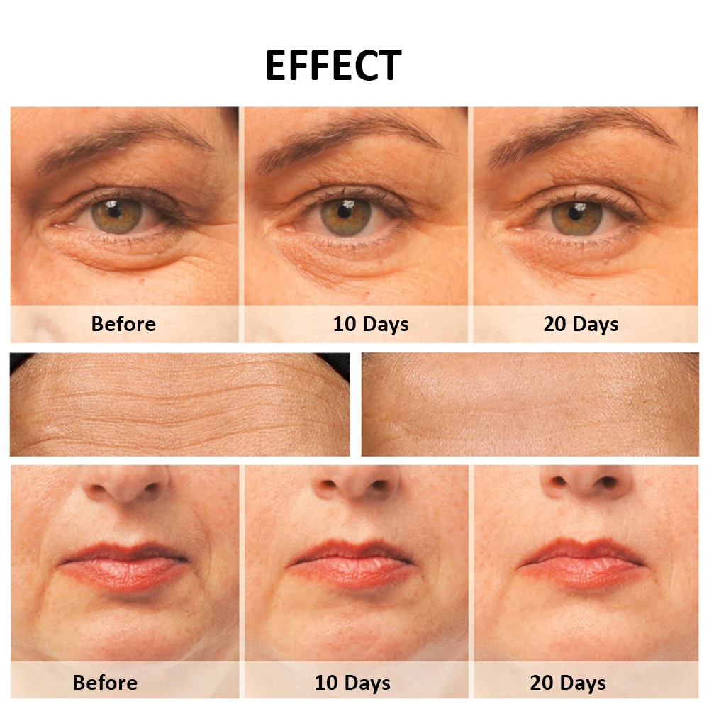 مدلك الوجه مكركرنت مدلك للوجه LED العلاج بالضوء شد الجلد الوجه رفع التجاعيد تقليل جهاز الجمال #6