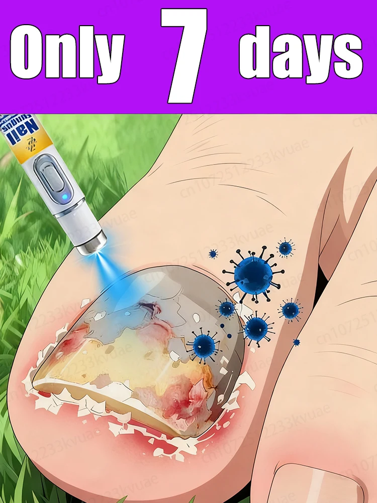 

2025 Hot Selling Nail Cleaning Tools.Rᴇᴍᴏᴠᴇ ɴᴀɪʟ ғᴜɴɢᴜs ᴀɴᴅ ᴇʟɪᴍɪɴᴀᴛᴇ ᴏɴʏᴄʜᴏᴍʏᴄᴏsɪs.