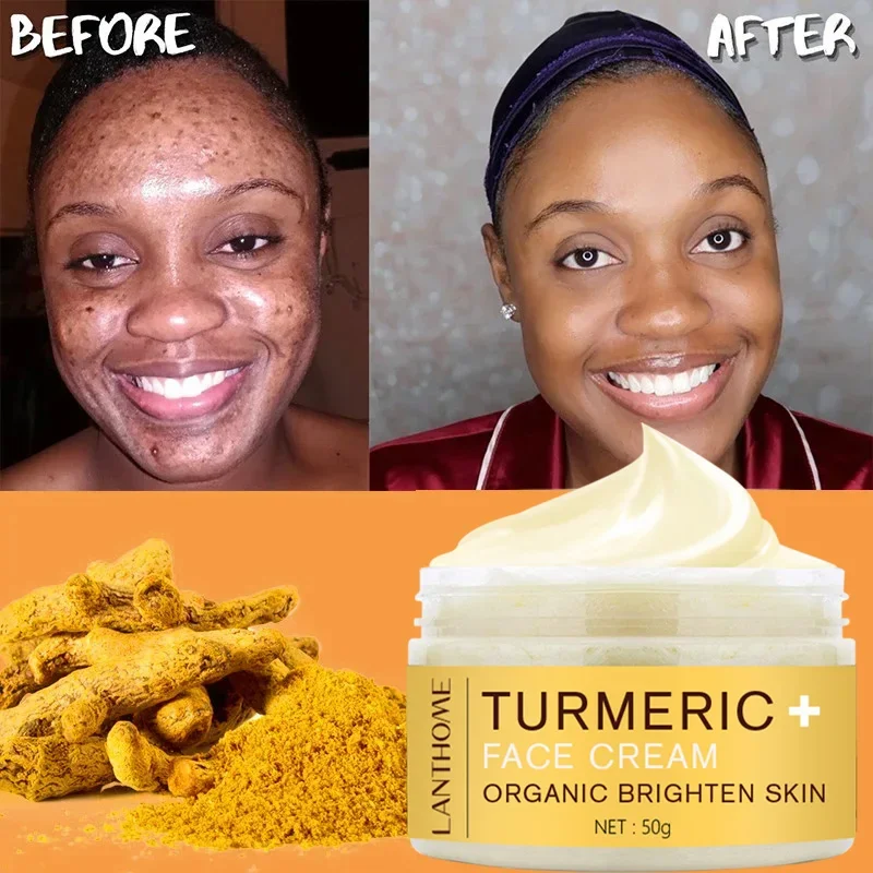 

50g Turmeric Face Cream Firming Skin Tightening Cream Remove Dark Spots Anti Wrinkle Shrink Pores Moisturizing Skin Care