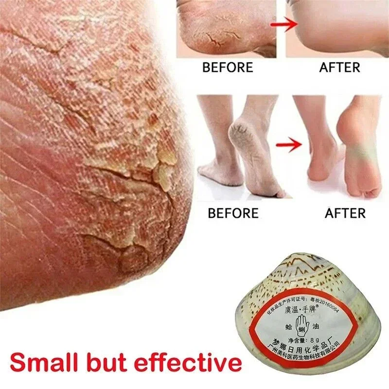 Traditional Classic Clam Oil Cracked Repair Cream Anti-drying Removal Dead Skin Hand Feet Foot Care Ointment Moisturize Care Oil