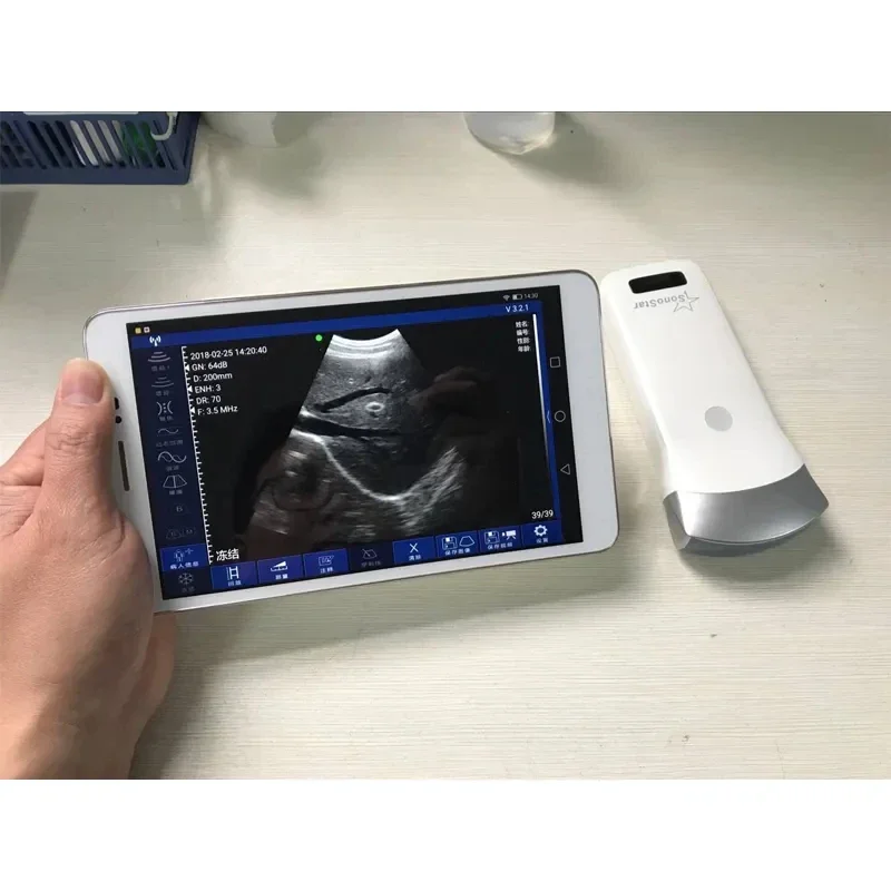 

Wifi wireless probe b/w ultrasound machine portable for phone wireless ultrasound scanner