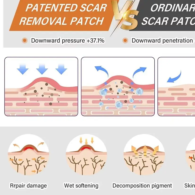 Practical Silicone Scar Sheets Self-Adhesive Scar Cover Tape Skin Care Waterproof Breathable Painless Effective Scar Repair Tape