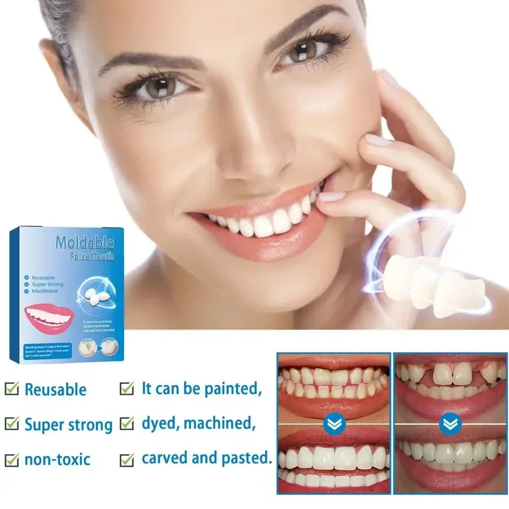 Temporary Tooth Repair Kit False Teeth Solid Glue Denture for Missing Broken Teeth Moldable Tooth Filling False Teeth Tools