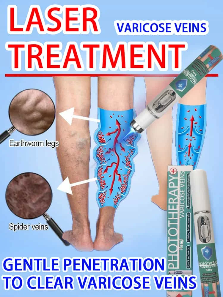 

Vein Laser