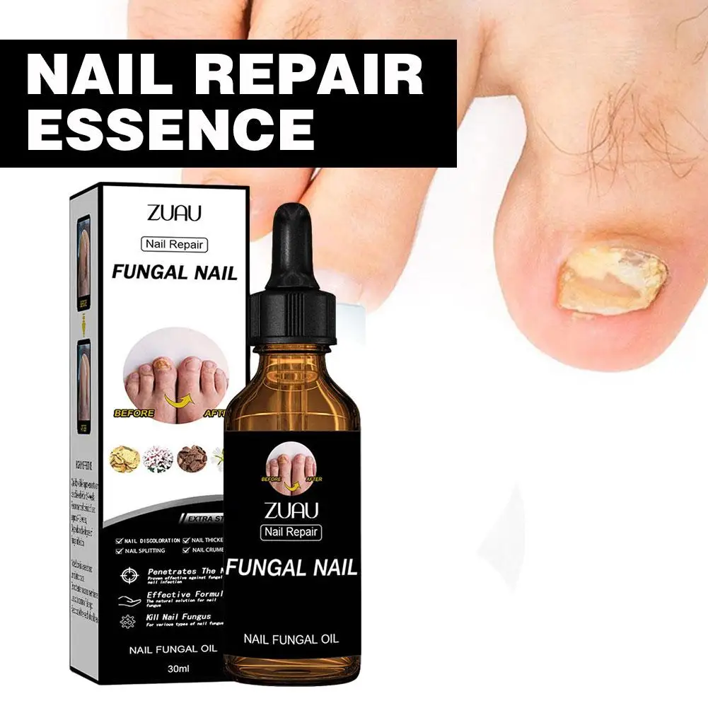 30ml Nail Repair Solution Thickening Brightening Nails Nail Nourishing Nail Moisturizing Gray Nail And Repair Removing Solu O6V1