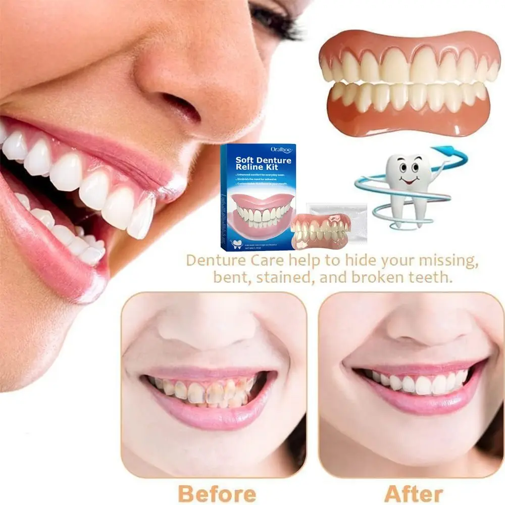 Silicone Denture Reline Kit Soft Comfortable And Firm Denture Silicone Reline Kit Safe And Durable Instant Instant Teeth