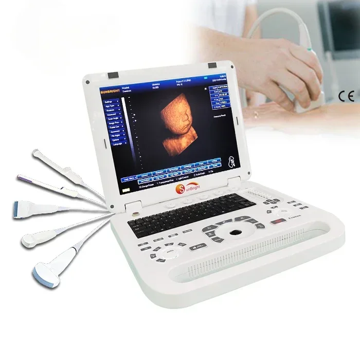 

15 inch MSK linear probe 3D Ultrasound Instrument For Hospital Use