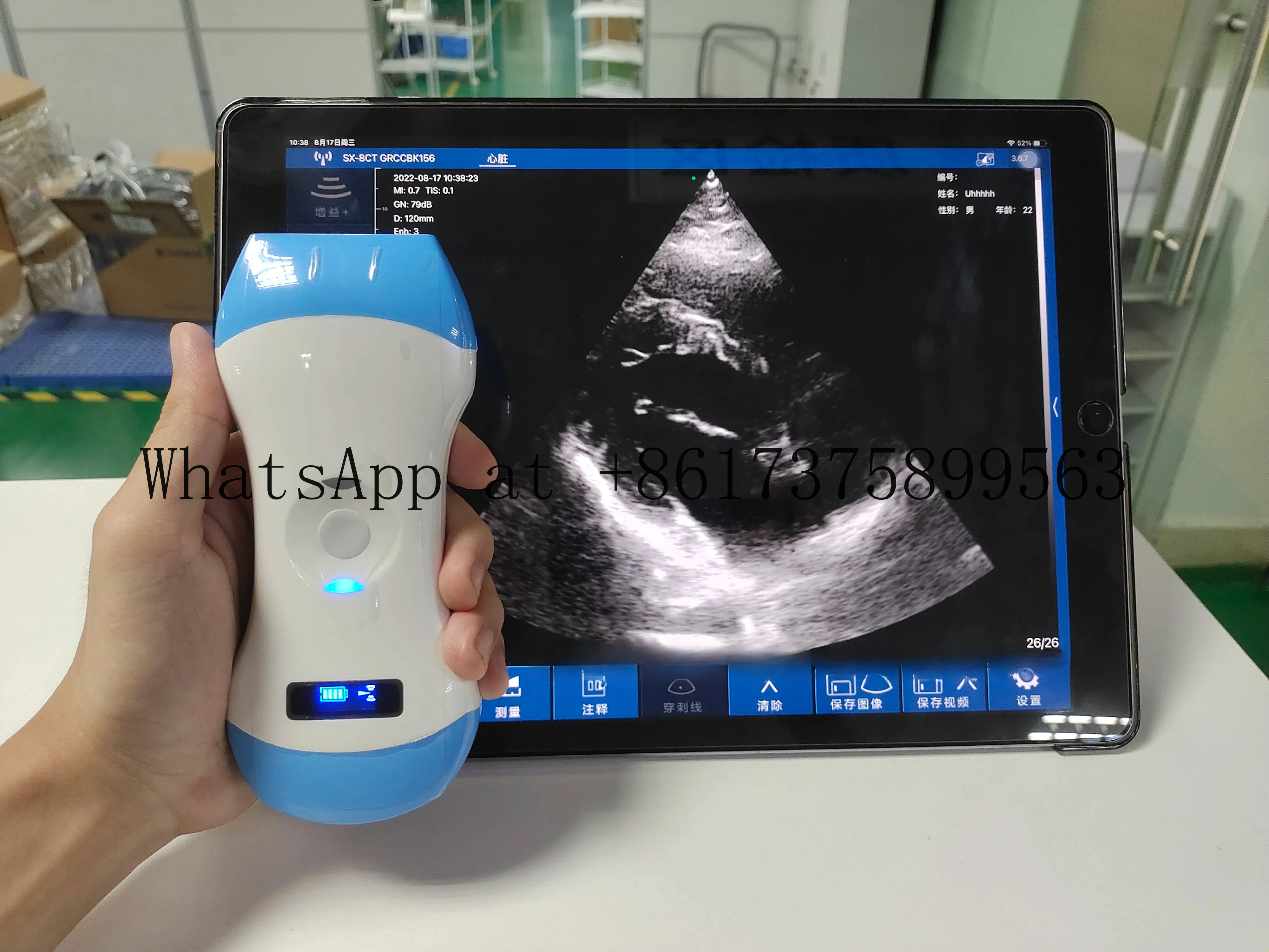 3-In-1 Wireless Sca…