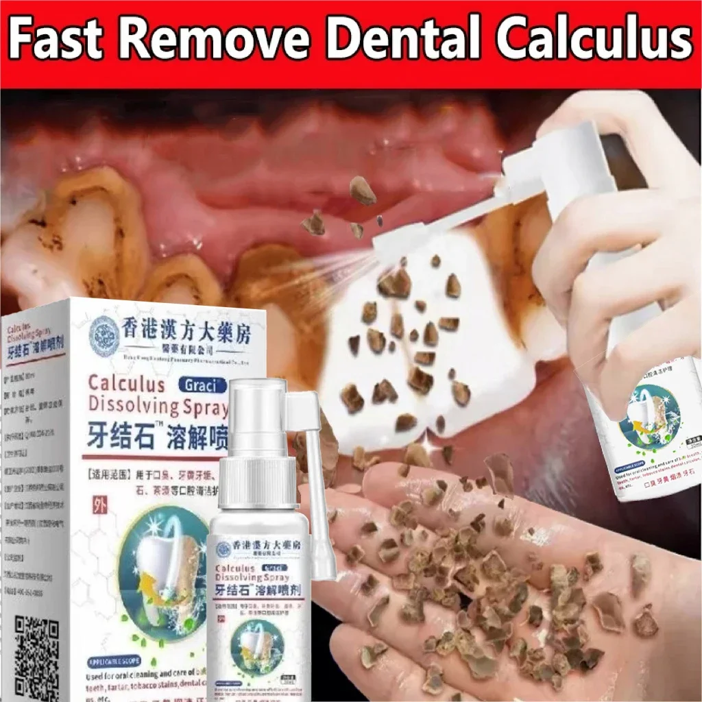 Dental Calculus Remover Teeth Whitening Spray Toothpaste Cleaning Oral Hygiene Removal Halitosis Plaque Stains Fresh Breath Care