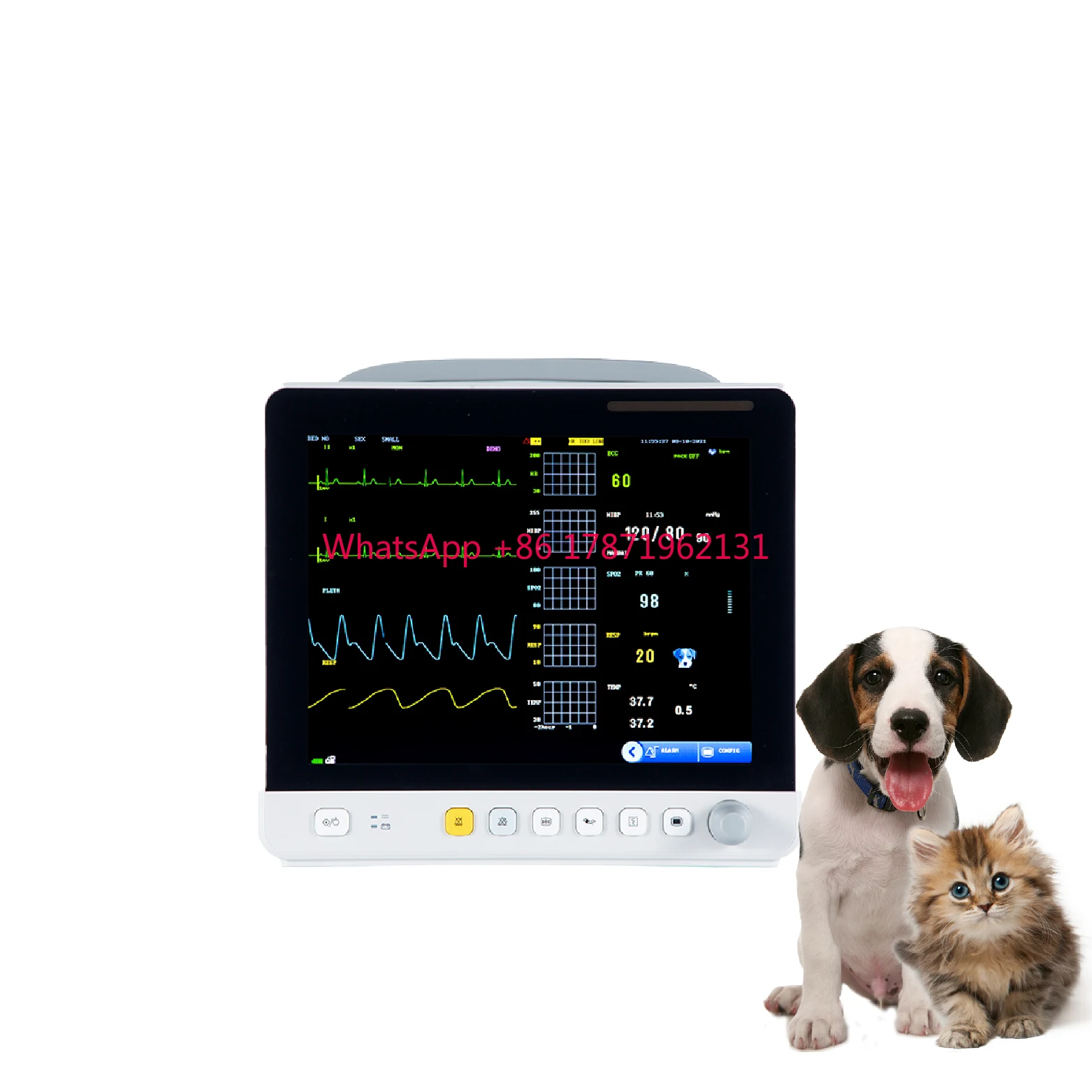 

Портативный Медицинский телефон, Icu, хирургические жизненно важные признаки, многопараметрический медицинский монитор