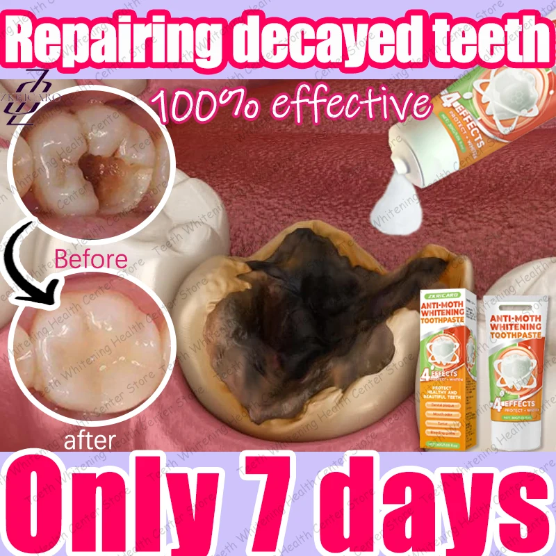 99% of people repurchase, hot selling, repair tooth decay