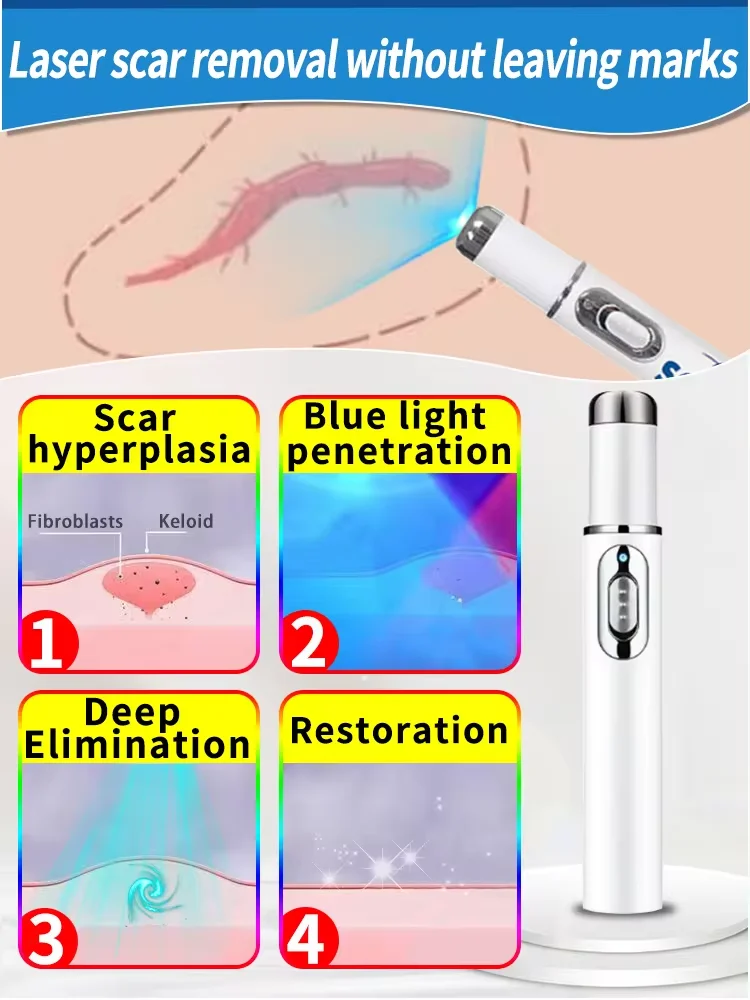 Riparazione cheloide Laser altamente efficace