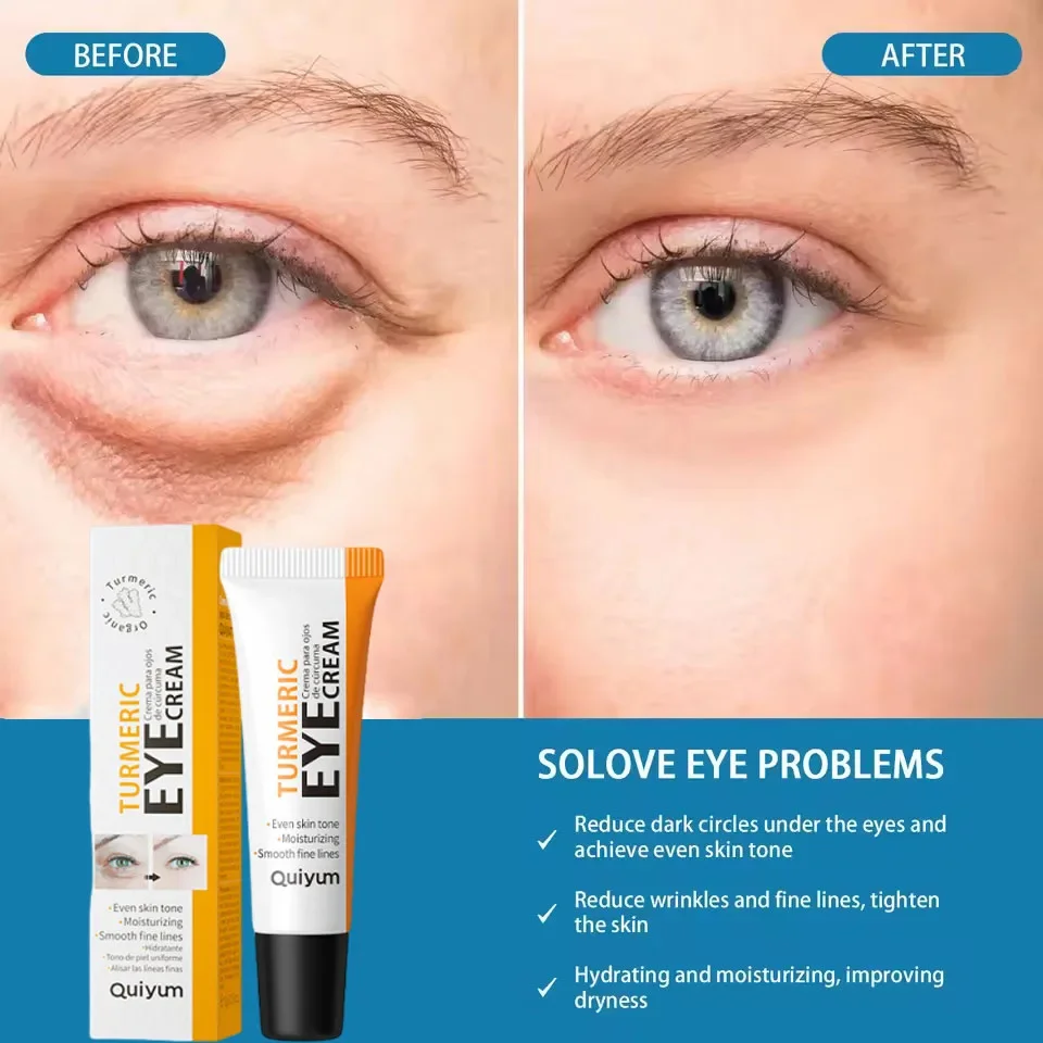 Creme instantâneo para remoção de bolsa de olhos, retinol, anti-rugas, firmador da pele, linhas finas, anti-círculo escuro, inchaço, iluminar, cuidados com os olhos