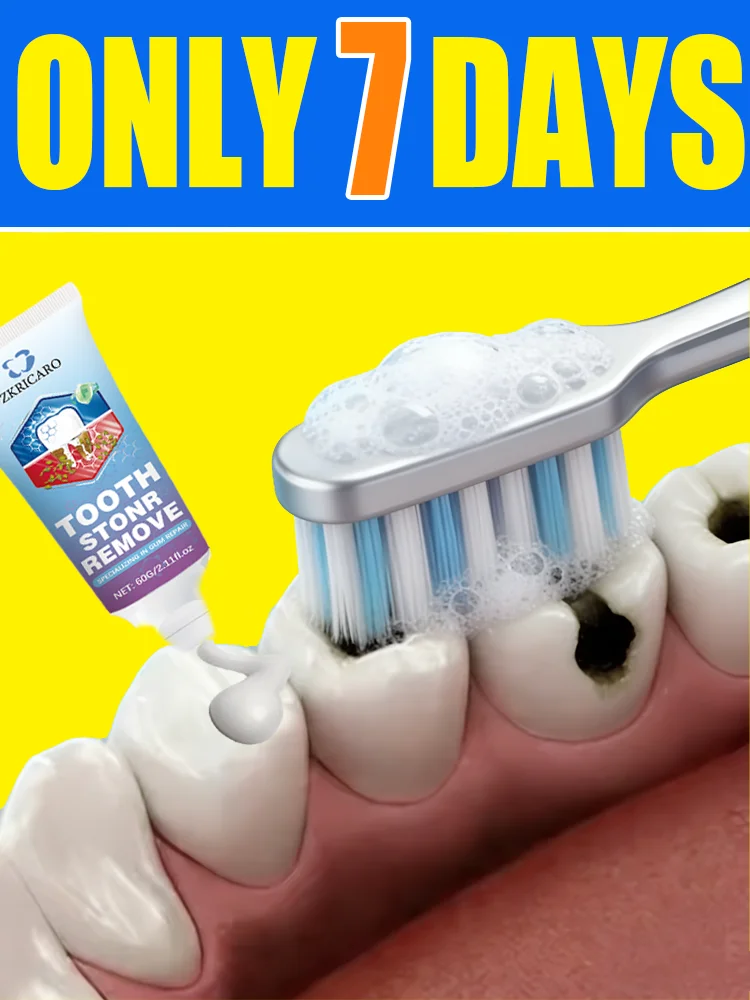 

Dᴇɴᴛᴀʟ ᴅᴇғᴇᴄᴛs ᴄᴀɴ ʙᴇ ʀᴇᴘᴀɪʀᴇᴅ ɪɴ ᴊᴜsᴛ 7 ᴅᴀʏs,allowing you to regain a confident smile.