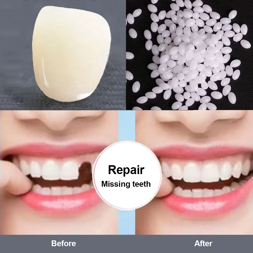 High Hardness Resin Tooth Permanent Repair Glue Shapeable Teeth Gaps Filling Teeth Repair Falseteeth Glue Safety Handmade