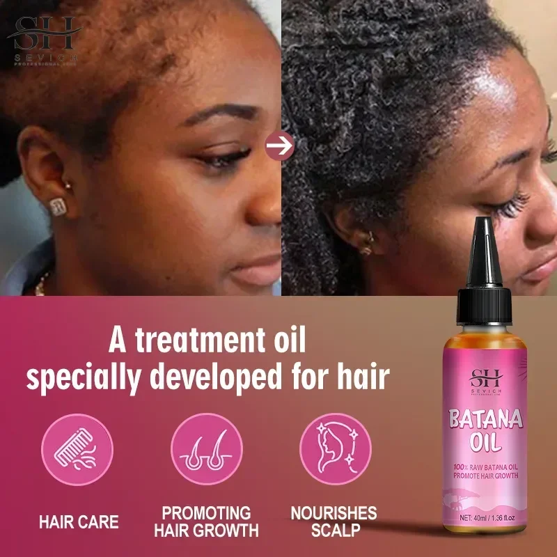 African Batana Oil Serum Fast Repair Baldness Hereditary Postpartum Seborrheic Hair Loss Hair Regrowth Treatment Serum Men Women