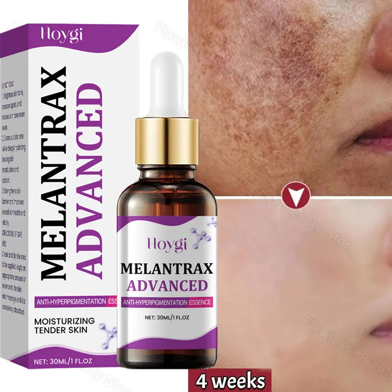 

Intense Dark Spots Remover Whitening Serum Face Freckle Melanin Correcting Anti-Pigmentation Acne Marks Brightening Skin Care