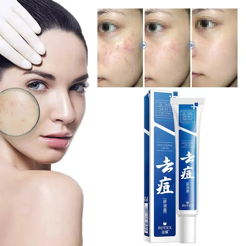 

Salicylic Acid Solution Essence 10mL Shrink pores and Acne Spot Removing Shrink Pores Oil-Control Brighten Face Skin Makeup