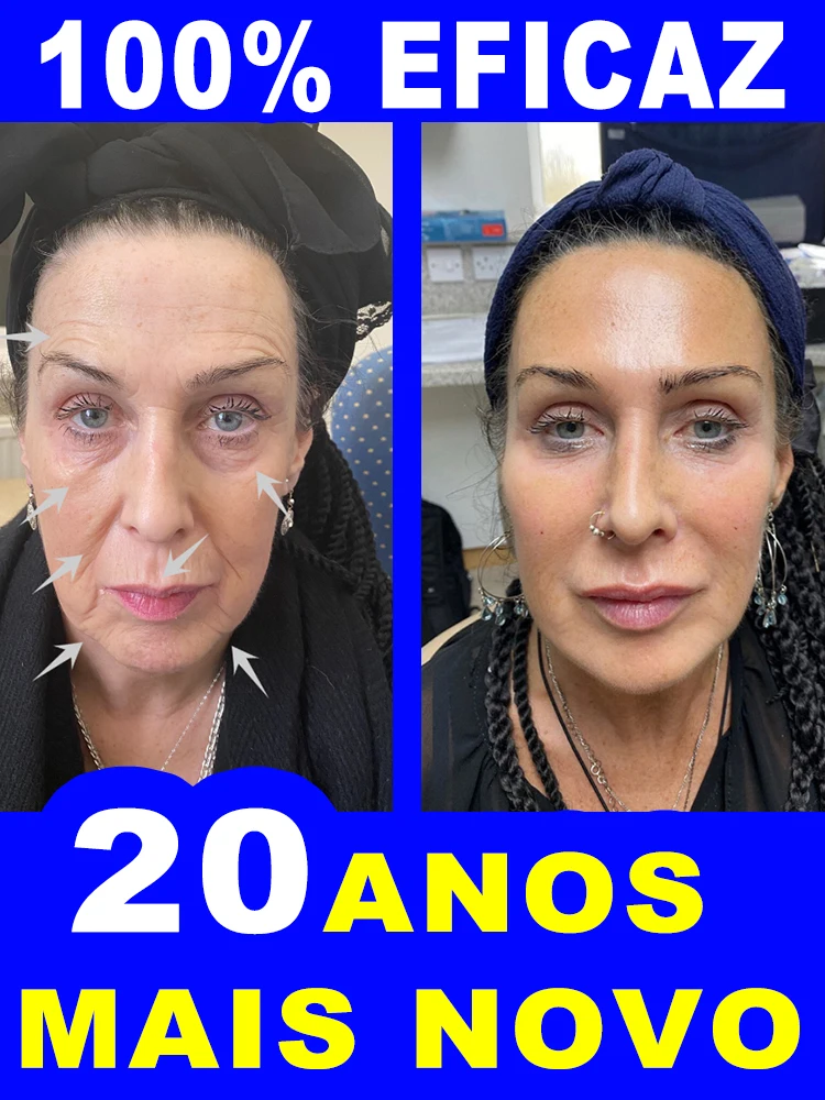 reducing-wrinkles-restoring-smooth-skin