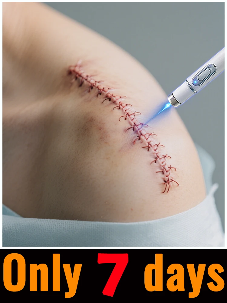 Bis ihm die Narbe verschwindet, finden Sie, dass es keinen Traum war