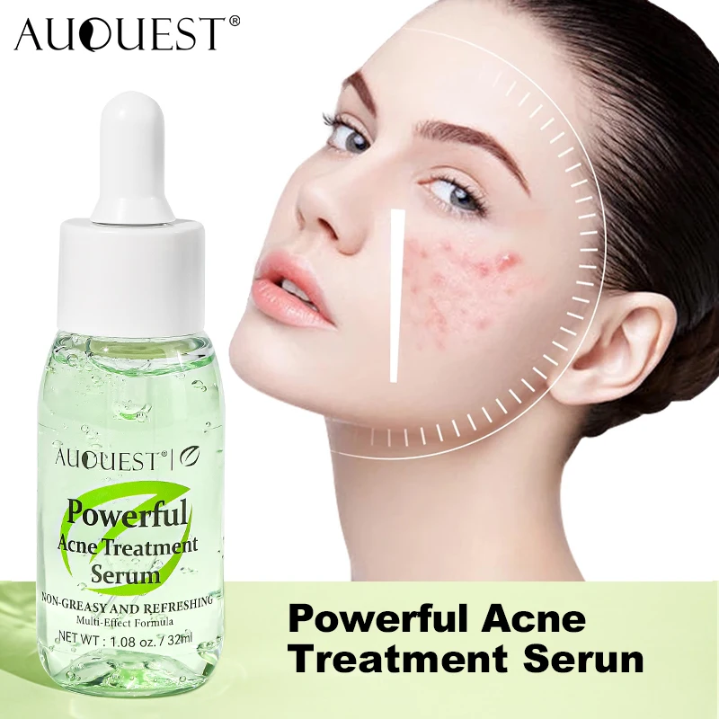 

AUQUEST Salicylic Acid Acne Treatment Face Serum Pimple Remover Oil Control Facial Herbal Acne Skin Care